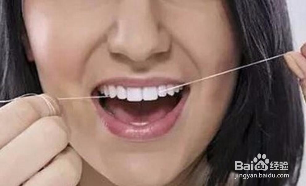 牙垢该如何清除？