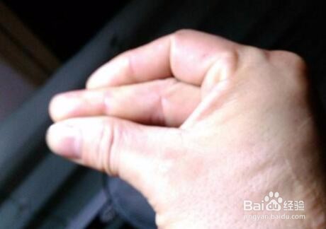 中风前兆及症状有哪些？如何预防中风发生