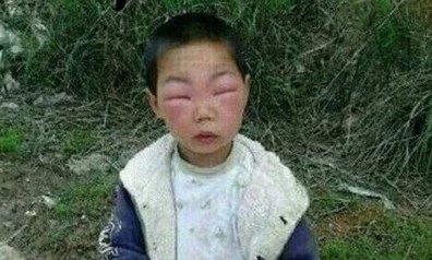 牙膏在生活中的妙用