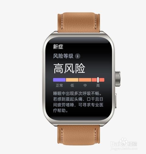 oppo watch 4 pro在健康管理方面有哪些升级？