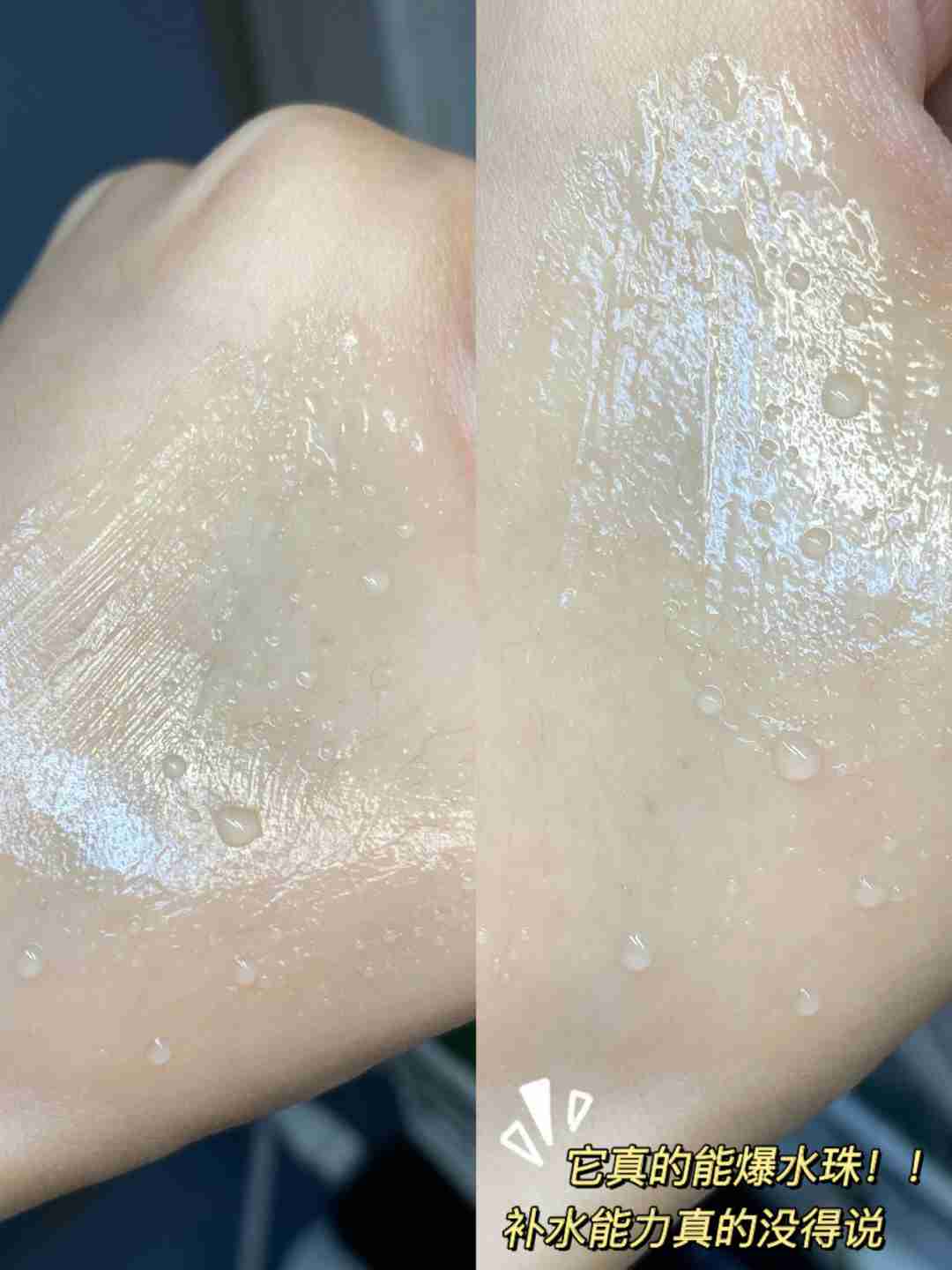 会爆水珠的免洗面膜你用了吗