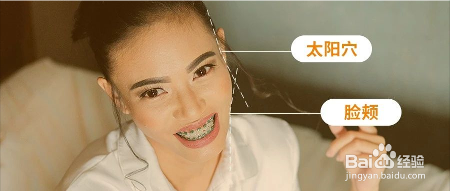 为什么戴牙套会出现牙套脸？