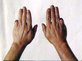 弹筝者怎样锻炼手指的灵活度