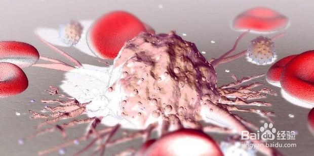 白血病的早期症状都有哪些