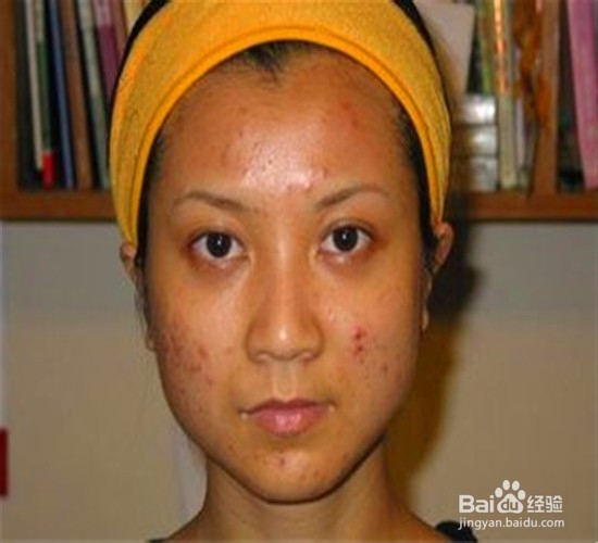 洋葱对人好处多多，你知道吗？