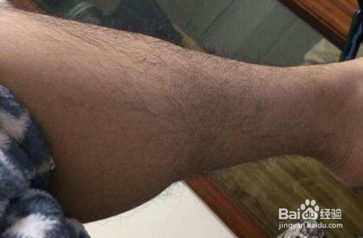 男生的腿毛有什么用呢?