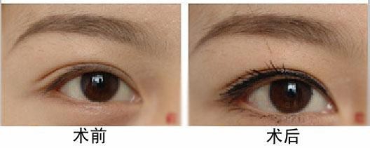 韩式半永久定妆眼线