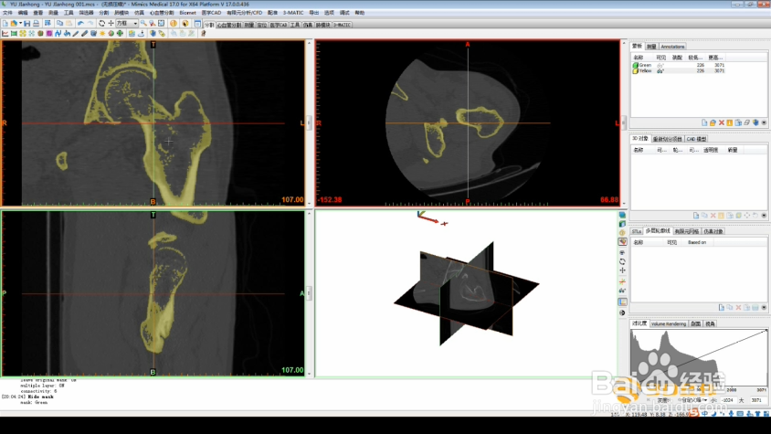 Mimics如何进行图像处理操作
