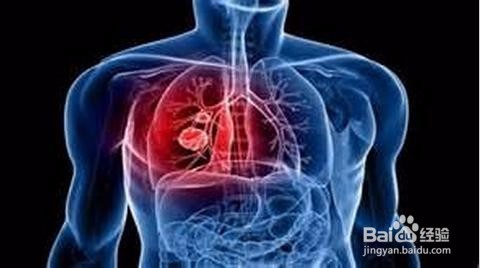 打羽毛球有哪些好处？