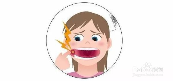 灼口综合征会传染吗?想看的都在这里!