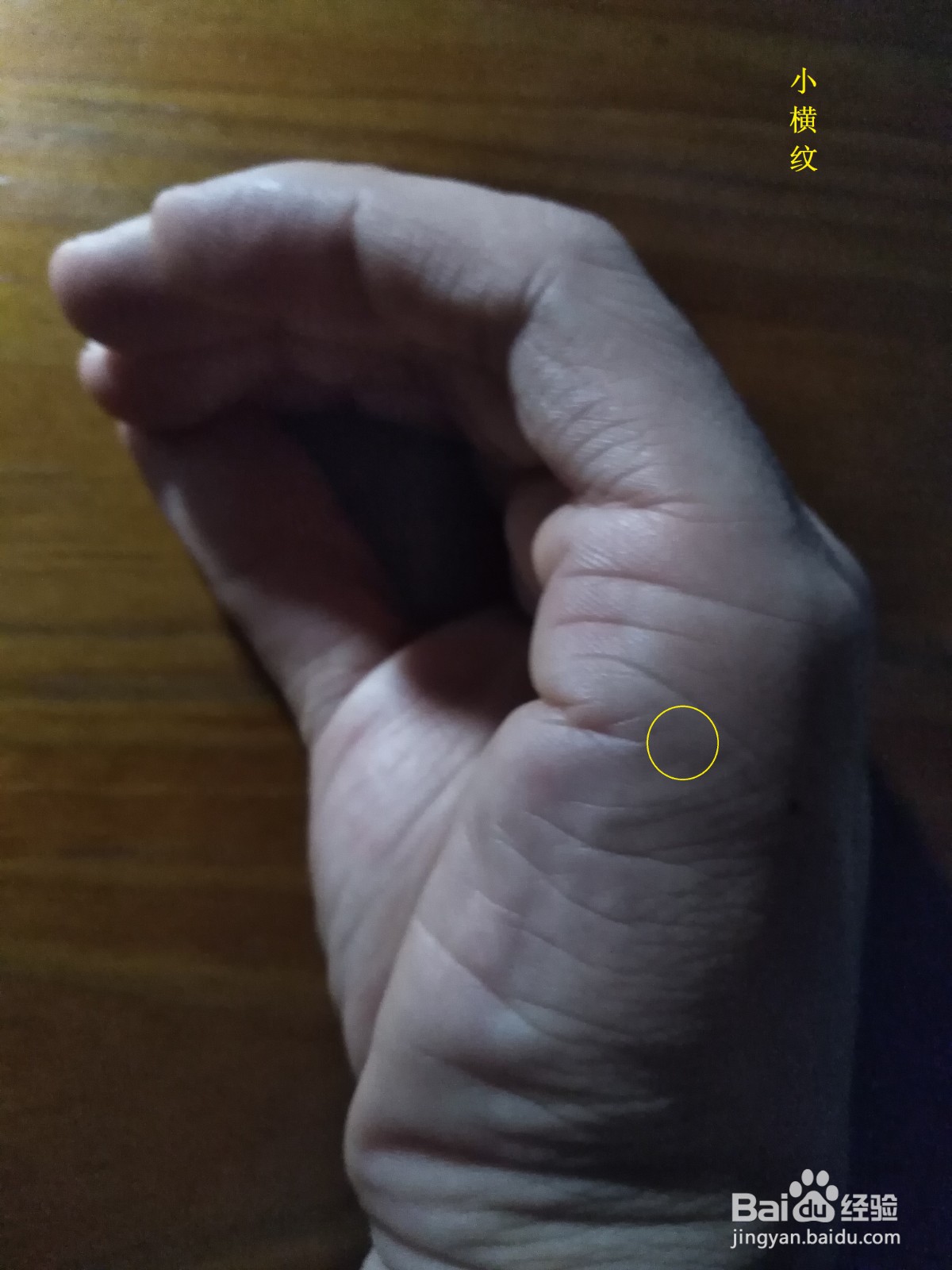 支气管炎怎么办