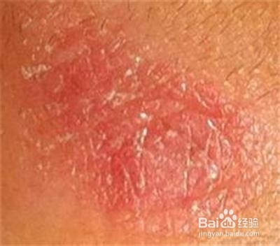 让你增强免疫力的几种食物：[2]