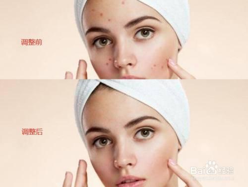 如何用PS去除图片人物脸上的斑点?