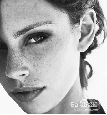 怎么分辨脸上长的什么斑