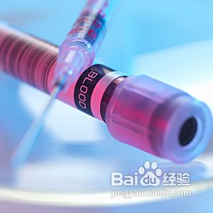 黄体发育不全怎么办