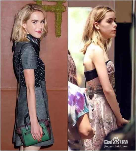 圆肩驼背怎么矫正