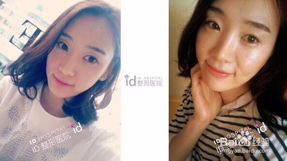 脸色发黄的调理方法