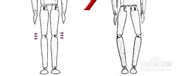 走出O型腿误区
