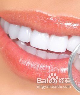 5大解析怎样美白牙齿