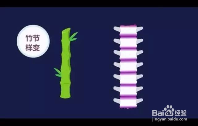 这种病被称”不死的癌症”，很多上班族都有！