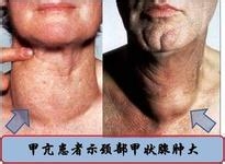 长时间便秘的原因