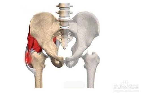 股骨头坏死怎么止痛