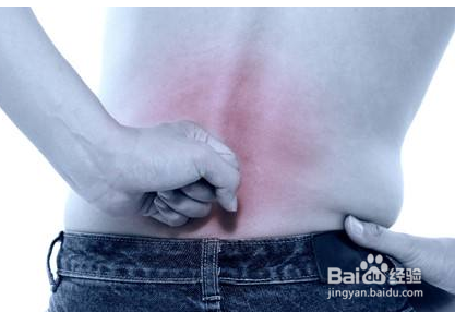 解决椎间盘突出症状的三个要点及误区