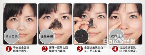 怎样快速挤出黑头