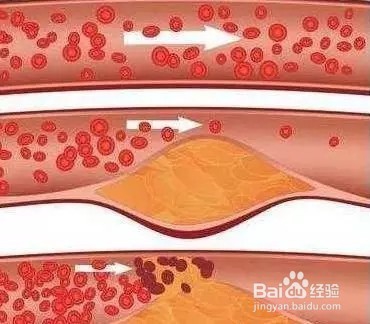 肌营养不良都有哪些治疗案例?壬九馨康