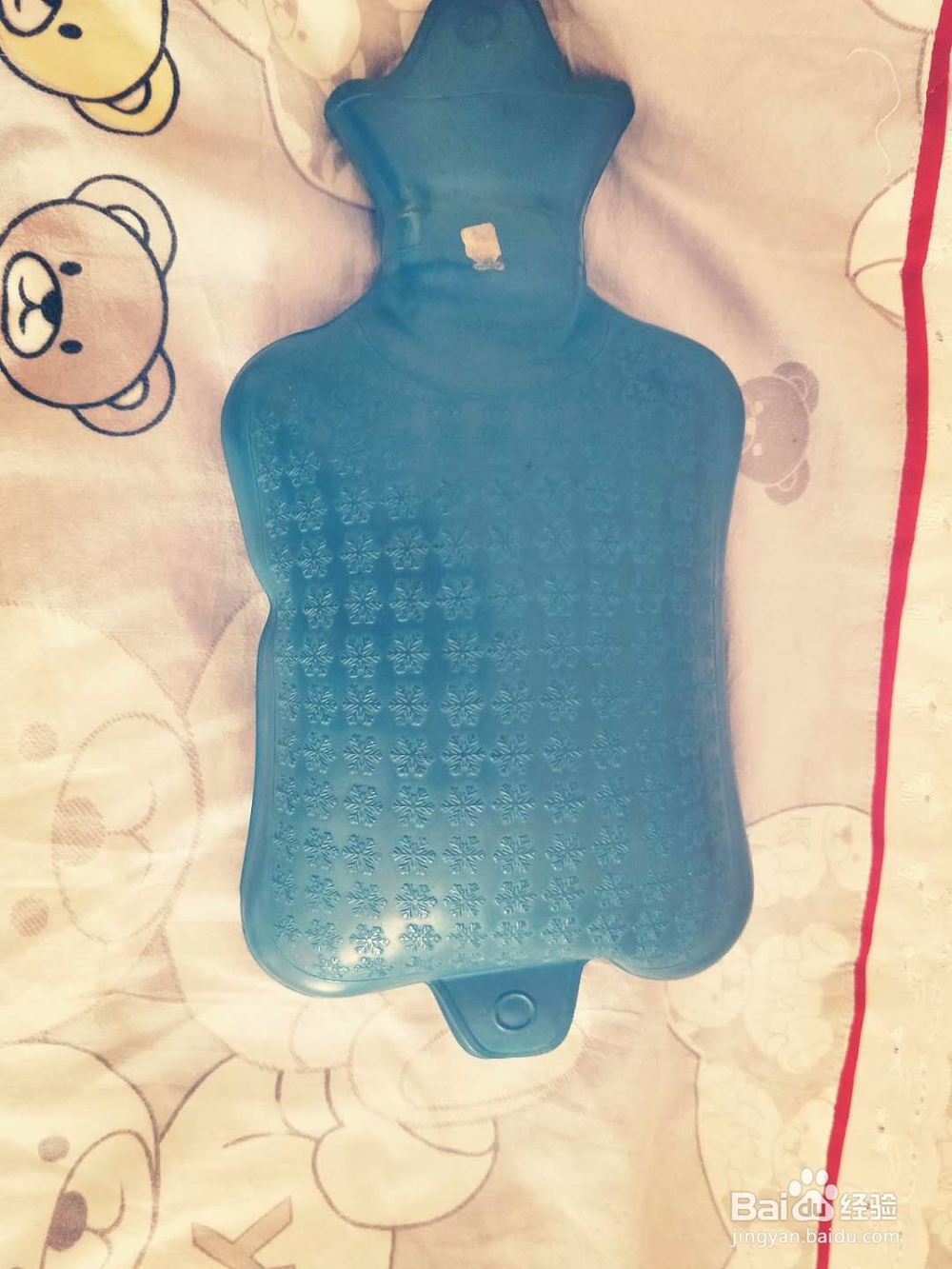 颈肩疼痛怎么办？热水袋来帮你