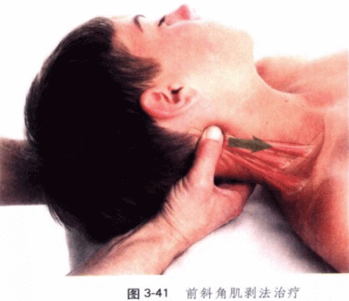 落枕处理中最重要的一组肌肉——颈深屈肌!