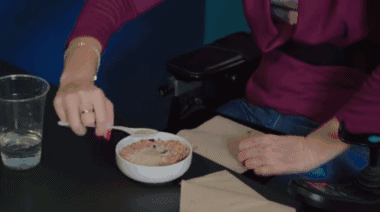 特发性震颤不治疗会严重吗