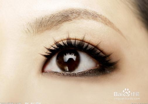 眼屎多是怎么回事