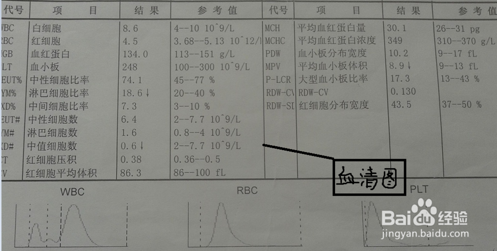 疑患腮腺炎怎么办