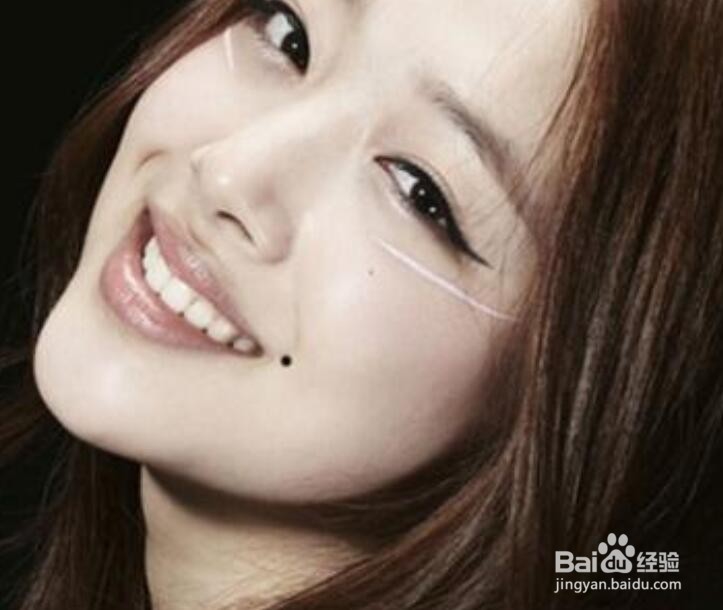 为什么痦子不能随便去掉？有什么危险？