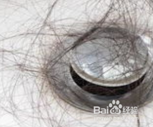 经常脱发怎么办