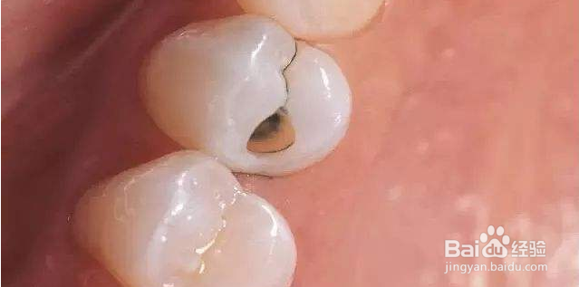 糖吃多了有哪些危害？