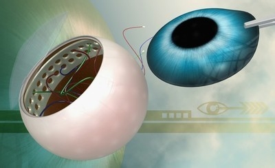 老年人为什么会得老花眼