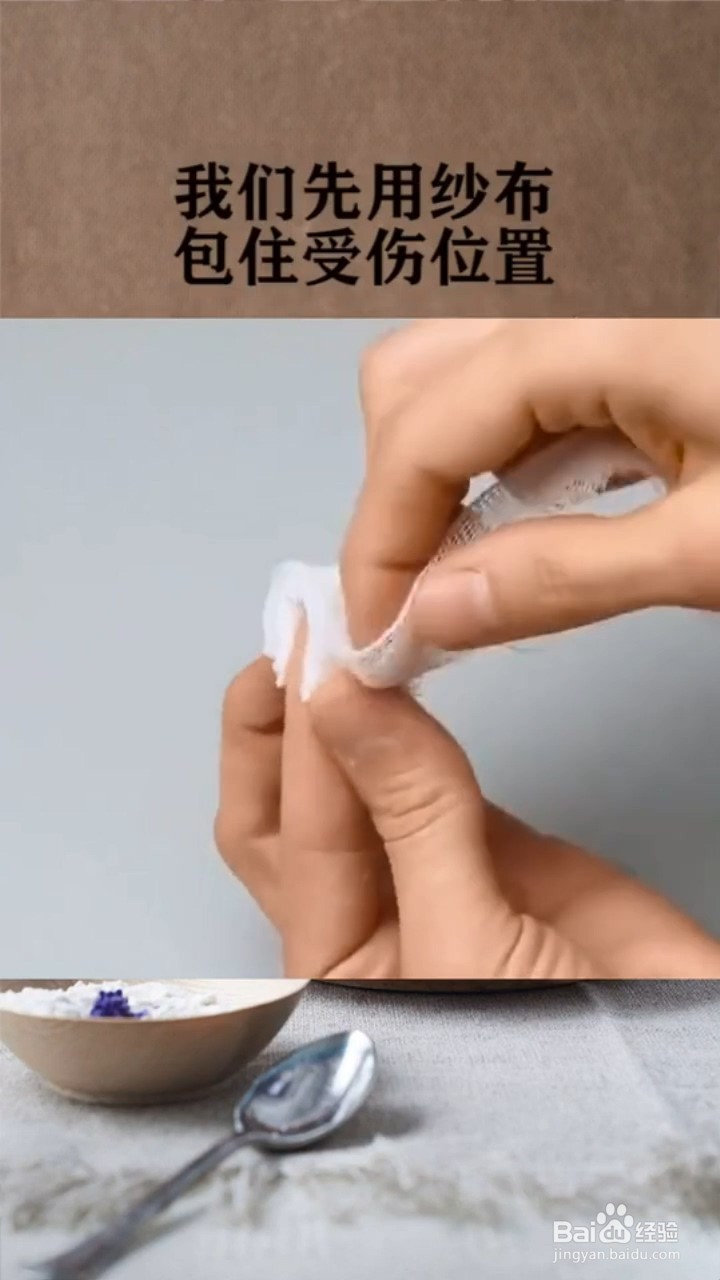 如何正确包扎手指头的伤口