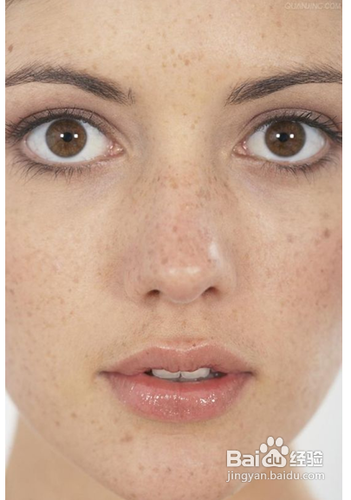 纯天然祛斑方法