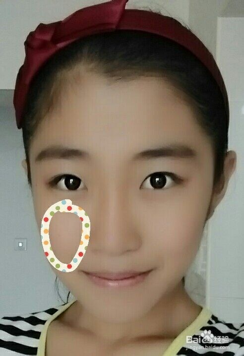 脸上痘痘的位置告诉你哪里出了问题