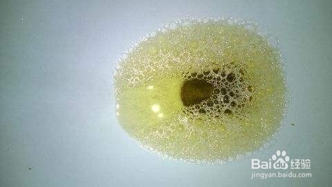 尿酸高患者吃芜菁粉有什么好处