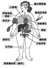 吃方便面的五大危害
