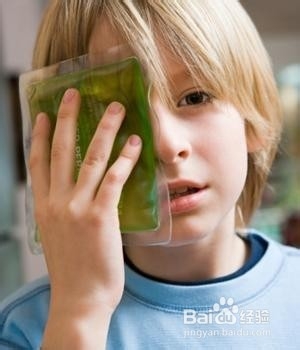 眼睛青肿如何治疗