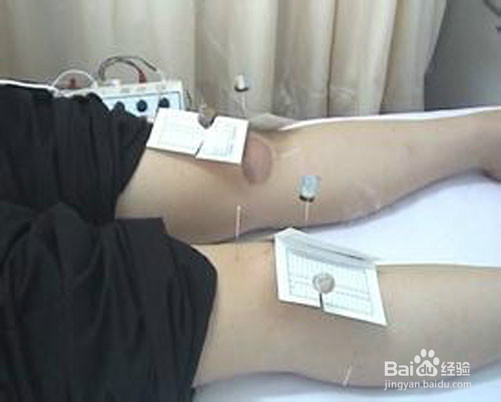 如何自我调养关节炎