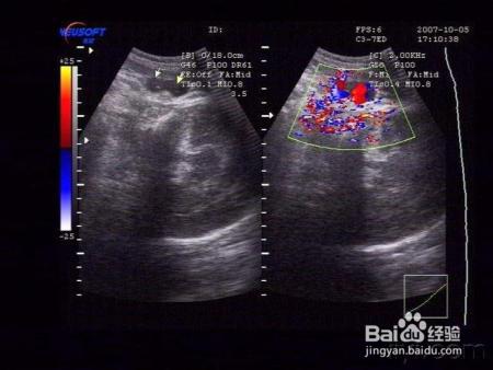 胎儿脐带绕颈，很可能是孕妈自己作出来的，哪些错误你不能犯？
