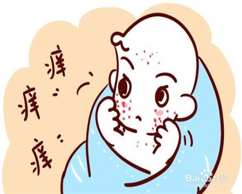 宝宝起水痘怎么护理