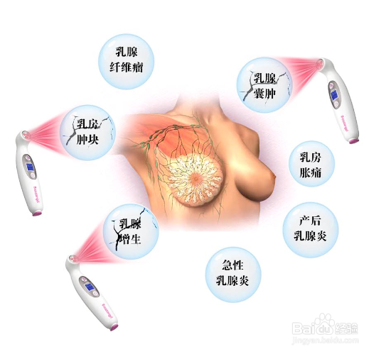 男性也能得乳腺癌 恶性程度高于女性
