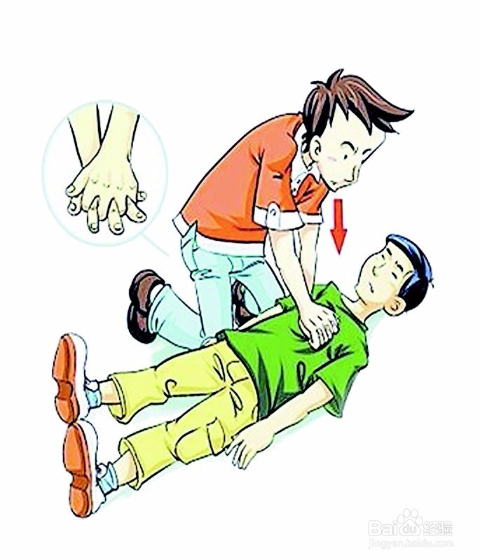 最新心脏病急救方法
