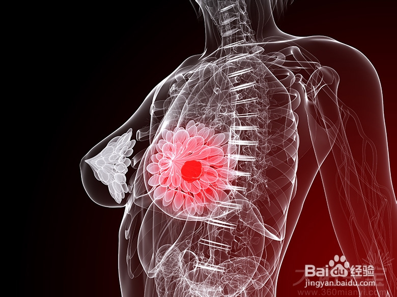 哪些症状提示着可能有乳腺癌